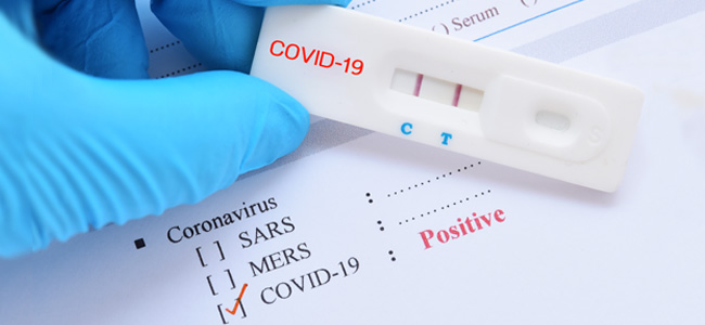 Positive test result by using rapid test device for COVID-19, no